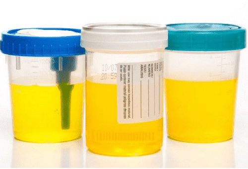 contenitori di urina di plastica