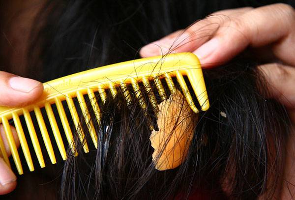 Kramtomosios gumos šukavimas iš plaukų