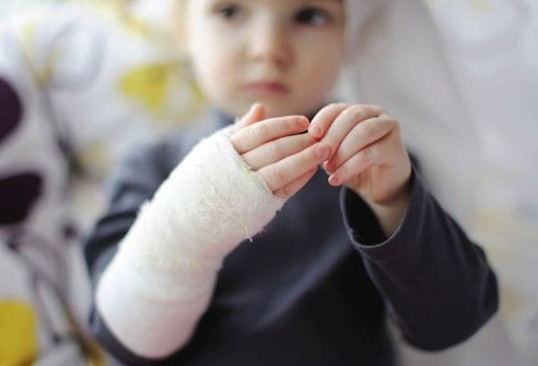 Een kind met een brandwond aan zijn handen